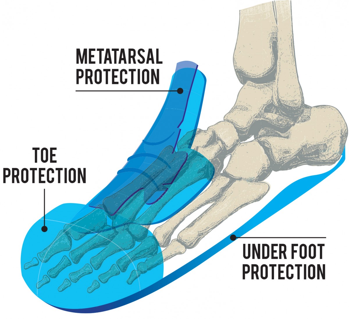 Metatarsal-Protection-Image-1200x1098